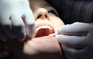 Les différentes utilisations du pansement pour les dents – Se soigner